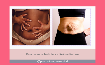 Bauchwandschwäche vs. Rektusdiastase: Verstehe den Unterschied